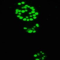 Systems Biology and Biotechnology of Microalgae (@sacco2comfuturo) 's Twitter Profile