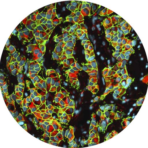 UAB GBS Cancer Biology Profile