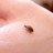 Bed Bug Information