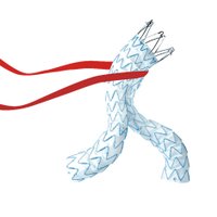 RunforAorticHealth (@run4aortichlth) 's Twitter Profile
