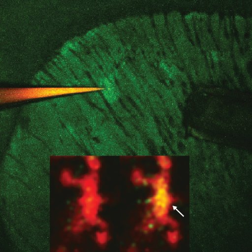 Our lab is focused on elucidating the brain circuit alterations that underlie OCD related behaviors, and the mechanisms guiding normal basal ganglia function.