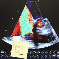 g&h CritCareEcho (@ghcritcareecho) 's Twitter Profile