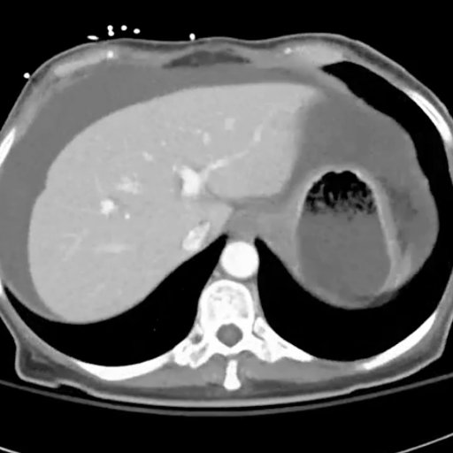 Abdominal radiology weekly case conference webinar Tuesdays 2pm EST/11am  PST. Join us, learn and share your cases!