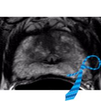 SAR Prostate DFP (@sar_prostatedfp) 's Twitter Profile
