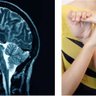 BendyBrain's profile picture. hypermobility + related conditions brain-body neuro research @bsmsmedschool | Chair RCPSYCH NDPSIG | https://t.co/HayQnrkpZk | @bendybrain.bsky.social