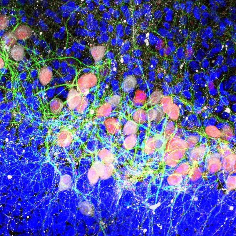 Based at @EdinUni_IRR at the University of Edinburgh. We are focussed on understanding and treating Parkinson's.