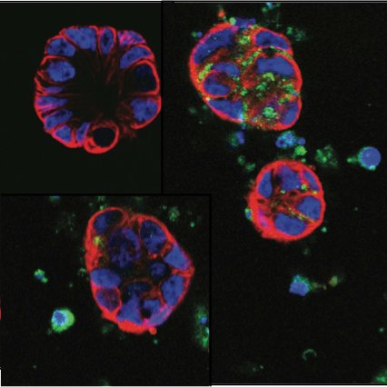 Breast and endometrial cancer, miRNAs and autophagy. Our lab hatched out first @UniofNewcastle, now sprouting @idibell_cat.