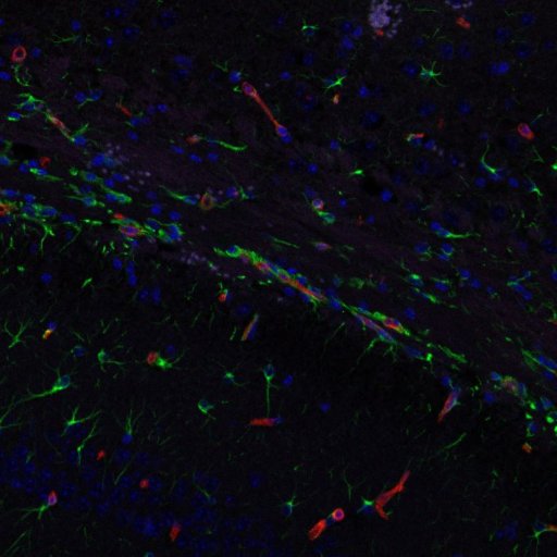 Consortium of researchers from Edinburgh, Glasgow, Manchester, Oxford & Cambridge investigating #extracellularmatrix defects in #SVD #dementia #stroke