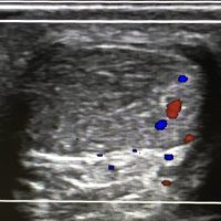 National Tendinopathy Centre (@tendonuk) 's Twitter Profile