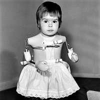 Irish Thalidomide Association (@thalidomideire) 's Twitter Profile Photo Irish Thalidomide Association (@thalidomideire) 's Twitter Profile Photo