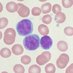 CLL Epigenetics (@cll_epigenetics) Twitter profile photo CLL Epigenetics (@cll_epigenetics) Twitter profile photo