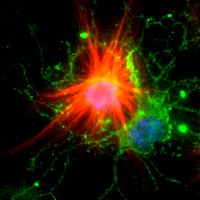 Crocker Lab (@gliallab) 's Twitter Profile