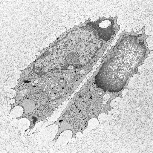 Our research bridges rare and common skeletal diseases in a holistic approach to understand cartilage development and ageing.