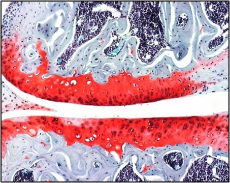 The Young Lab are based at Newcastle University. Our aim is to understand, and ultimately prevent, the cartilage loss that typifies osteoarthritis