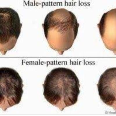 we have provide best hair transplant and cosmatic procedure