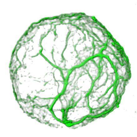 Group at CIB-CSIC working on Posttranslational Modification of Proteins, focusing on Lipoxidation, Intermediate Filaments, Drug-protein interactions.