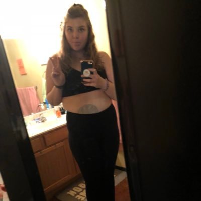 ABeautyWithABag's profile picture. Hi I’m Ryleigh✌️ I Crohn’s Disease I Colostomy | Stoma named Marigold I Seasonal Depression & Anxiety 🌞I Grad Student
