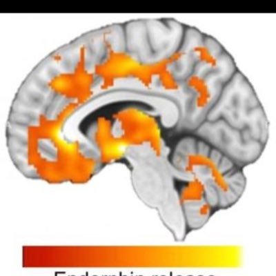 Can be found on the happy side of the brain  🧠