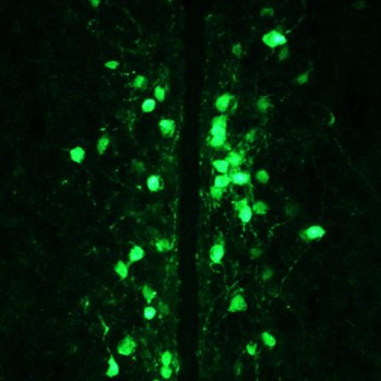 Sex differences, sexual differentiation of the CNS, and the role of gonadal steroid hormones in regulating stress, anxiety, and depression. @ualbany