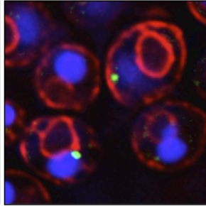 Cell Biology lab at UTSW @UTSWNews. We study lipid droplets and the organization of metabolism in cells.