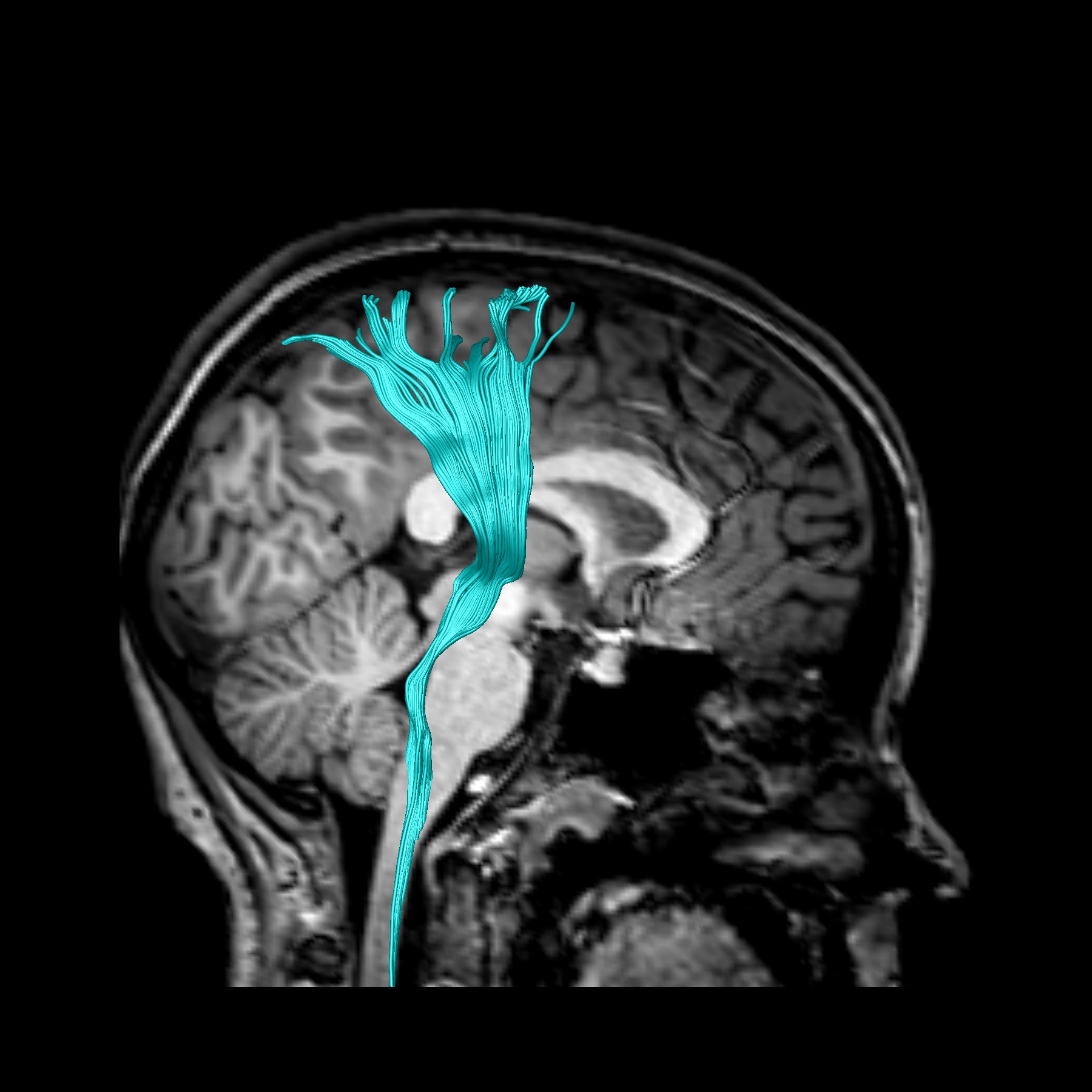 Neuroplasticity and Multimodal Imaging
