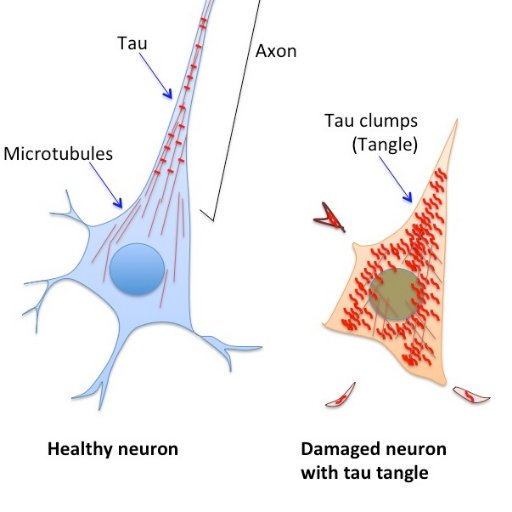 Research group at Reta Lila Weston Institute, UCL Institute of Neurology looking into genetics and molecular aspects of neurodegeneration in tauopathies