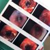 The IP Docs (@ip_pulmonology) Twitter profile photo The IP Docs (@ip_pulmonology) Twitter profile photo