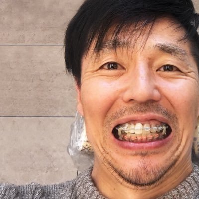 ケン 歯列矯正の全記録 Kyoseinokiroku Twitter ケン 歯列矯正の全記録 Kyoseinokiroku Twitter