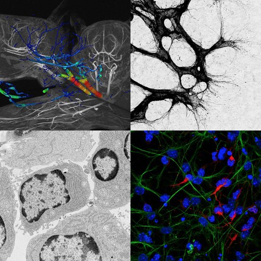 We take a holistic approach to understand health & disease and research #cancer, #immunity, #nervous system, #heart, #blood vessels, #bone and #glycoproteomics.