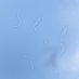 Get Rid Of Eye Floaters (@floatersfree) Twitter profile photo
