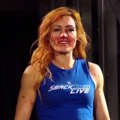 Becky Lynch. (@FireBurnsWithin) / X