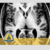 Johns Hopkins Neuroradiology (@hopkinsneurorad) 's Twitter Profile