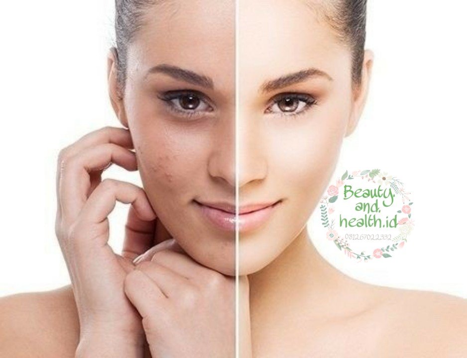 Beauty and Health Herbal