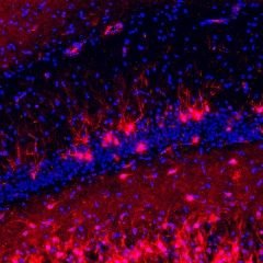 brains. microglia. hot takes on nonsense. she/hers.