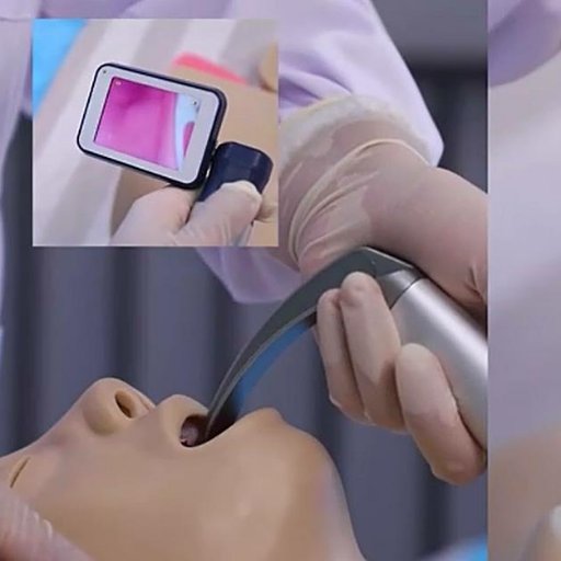 13 years Medical Paramedic inbubation difficult airway 🏐Solution, CE marked FDA Pedning France ,Holland ,Saudi Arabia ,Thai chose quality win more