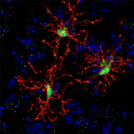 #Neuroimmunology lab @UCIrvine studying the role of #microglia in #Alzheimer’s disease and developing #iPSC-microglia based therapeutic approaches