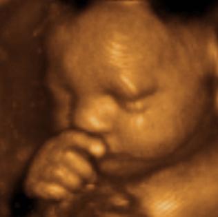 With our 3D and 4D Ultrasound imaging, you can now see your baby in the womb, up close and personal.