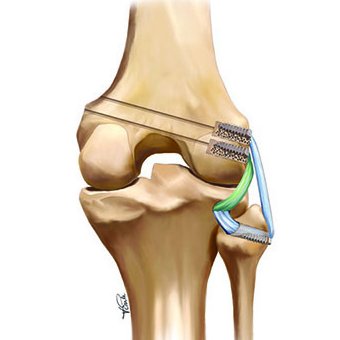 Medical & Scientific Illustrator specializing in MSK anatomy/physiology & sports med. Love explaining research via #medart #sciart. Feel free to DM for estimate