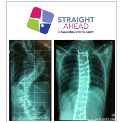 Straight Ahead is an orthopaedic charity based in Crumlin hospital.  Straight ahead take the time critical children off the HSE waiting lists.