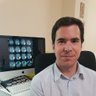 MatiasGuiu's profile picture. Neurólogo | #Afasia progresiva primaria #aphasia. #primaryprogressiveaphasia Demencia frontotemporal #FTD, Alzheimer. #neuropsychology #TMS #COVID @IIS_IdISSC