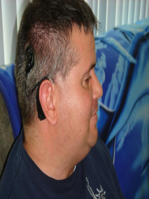 Celebrating 15 years enjoying cochlear implants in my head!! Amateur Radio: N2ETO. c: 303-552-6970. e: paulmigs@mysero.net