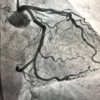 Hemodinamica_LaPaz (@hemodin_lapaz) 's Twitter Profile Photo Hemodinamica_LaPaz (@hemodin_lapaz) 's Twitter Profile Photo