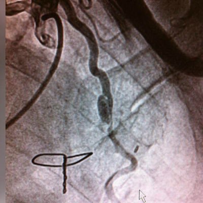 Unidad de Hemodinámica. Hospital Universitario y Politécnico La Fe. Objetivos: la excelencia, docencia e investigación. CiberCV.