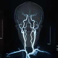 Sun Valley Cerebrovascular Conference (@sunvalleycvconf) 's Twitter Profile