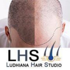 Hair Transplant In Ludhiana  Revitalize Studios Ludhiana