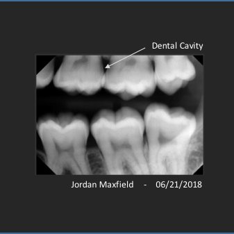 JordanMaxfields's profile picture. I never wait in line but often wait on line.