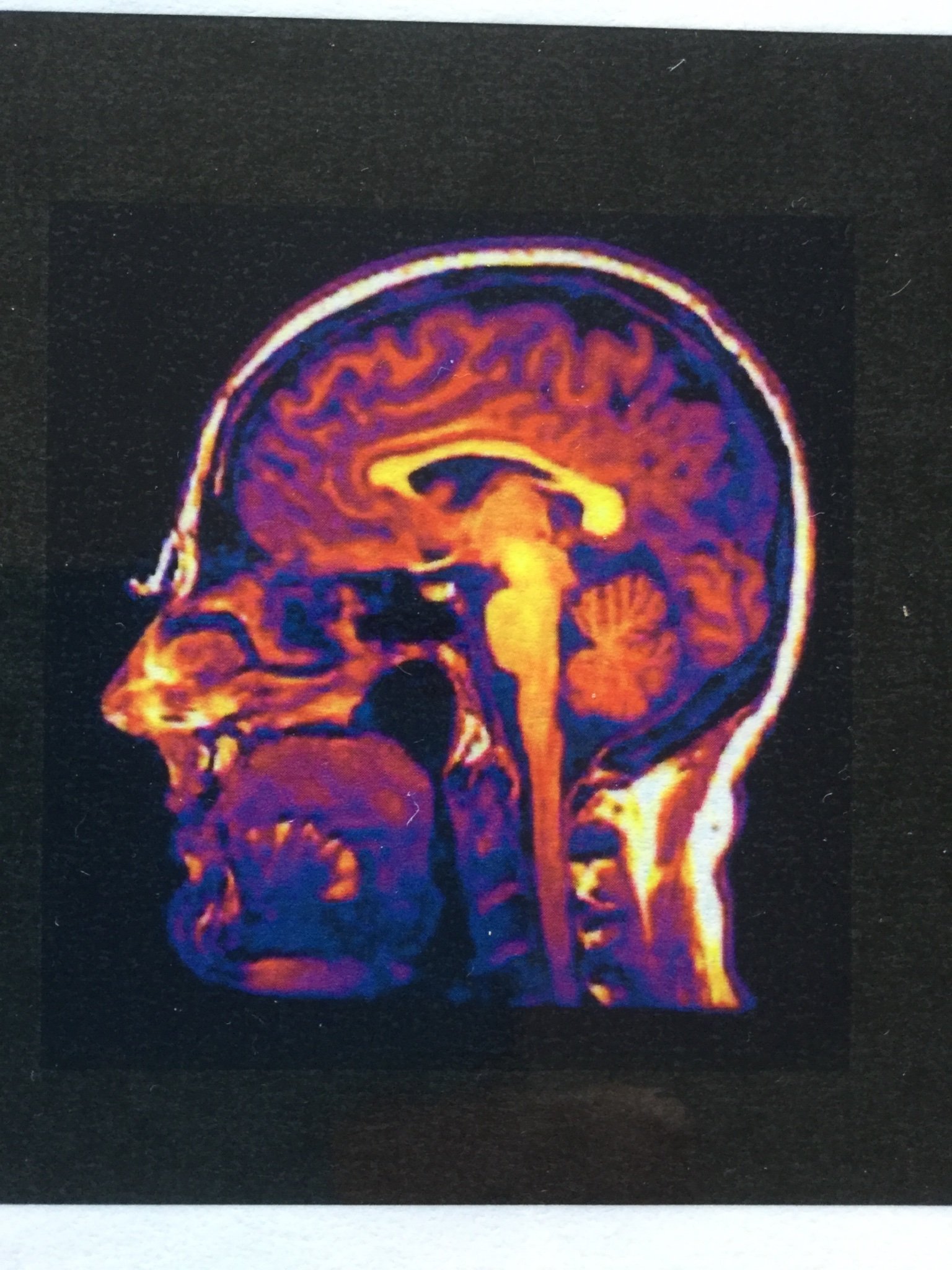 OrthoptiK's profile picture. Orthoptist;
Trainee Advanced Clinical Practitioner