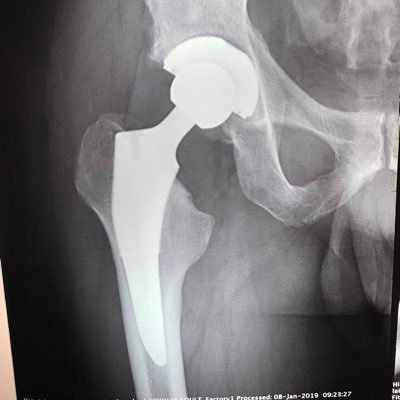 Cirujano Articular de Cadera y Rodilla. En Monterrey.https://t.co/vLuu5wKIKL