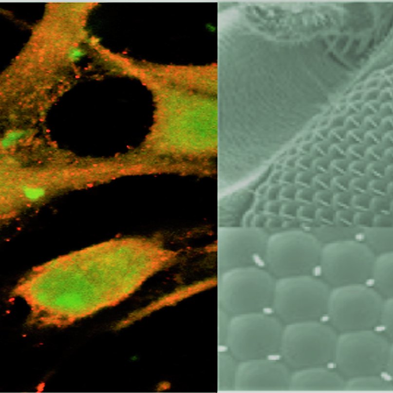 IIT-Bombay | BSBE | We explore several aspects of functional & disease amyloids | We play with scaffolds of amyloid based hydrogels | NDD, Organoids, Cancer |