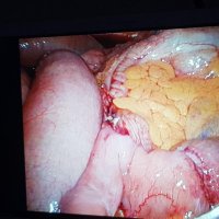 SoMe4Peritoneum (@speritoneum) 's Twitter Profile